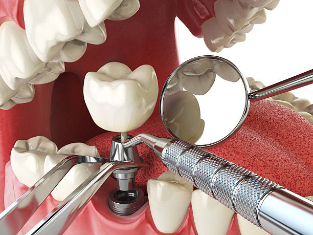 Best Emergency Cosmetic Dentistry in Locust Grove, GA